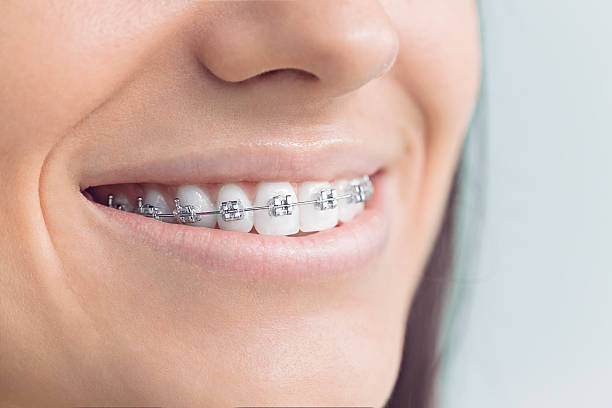 Best Invisalign and Clear Aligners  in Riviera Beach, MD